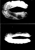 Picture 20 of 27 from Three-Dimensional Computer Graphics Brain-Mapping Project (1988), leaf 111