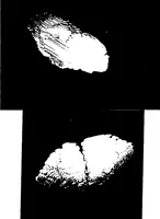 Picture 23 of 27 from Three-Dimensional Computer Graphics Brain-Mapping Project (1988), leaf 115