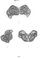 Picture 24 of 27 from Three-Dimensional Computer Graphics Brain-Mapping Project (1988), leaf 117
