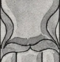 An illustration from General catalog 1911-1912 (1912)