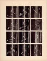 An illustration from The Automotive Ignition Coil (1932)