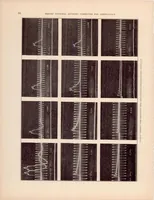 An illustration from The Automotive Ignition Coil (1932)