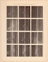 An illustration from The Automotive Ignition Coil (1932)