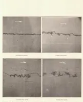 An illustration from Photomicrographic Studies of Fuel Sprays (1934)