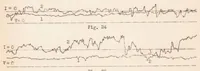 An illustration from Methods of Recording Rapid Wind Changes (1932)