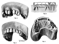 An illustration from Scientific American, Vol. 65, No. 16 (1891) (1891)
