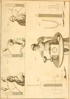 An illustration from An account of the late improvements in galvanism : with a series of curious and interesting experiments performed before the commissioners of the French National Institute, and repeated lately in the anatomical theatres of London (1803)