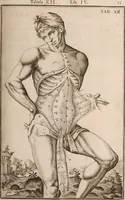 Picture 156 of 293 from Adriani Spigelii Bruxellensis (1645), leaf 398