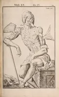 Picture 159 of 293 from Adriani Spigelii Bruxellensis (1645), leaf 404