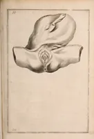 An illustration from Adriani Spigelii Bruxellensis (1645)