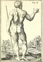 Picture 33 of 141 from Adriani Spigelii ... De humani corporis fabrica libri decem, tabulis XCIIX aeri incisis elegantissimis, nec antehac visis exornati. Serenissimo Ioanni Cornelio Venetiarum duci dicati : opus posthumum : Daniel Bucretius Vratislaviensis Philos. & Medic. D (1632), leaf 440