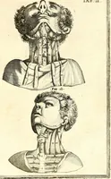 An illustration from Adriani Spigelii ... De humani corporis fabrica libri decem, tabulis XCIIX aeri incisis elegantissimis, nec antehac visis exornati. Serenissimo Ioanni Cornelio Venetiarum duci dicati : opus posthumum : Daniel Bucretius Vratislaviensis Philos. & Medic. D (1632)