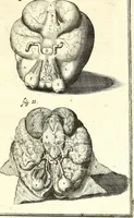 An illustration from Adriani Spigelii ... De humani corporis fabrica libri decem, tabulis XCIIX aeri incisis elegantissimis, nec antehac visis exornati. Serenissimo Ioanni Cornelio Venetiarum duci dicati : opus posthumum : Daniel Bucretius Vratislaviensis Philos. & Medic. D (1632)