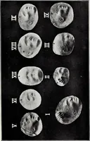 An illustration from After death--what? : Spiritistic phenomena and their interpretation (1909)