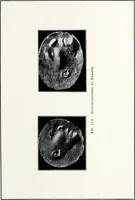 Picture 46 of 47 from After death--what? : Spiritistic phenomena and their interpretation (1909), leaf 348