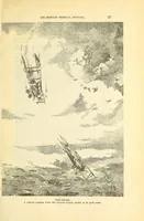 An illustration from Air service medical manual (1918)