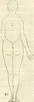 An illustration from Alberti Dvreri clarissimi pictoris et geometrae De symmetria partium humanorum corporum libri quatuor : è germanica lingua in latinam versi (1557)
