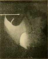 Picture 52 of 62 from The alimentary tract : a radiographic study (1915), leaf 192