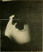 An illustration from The alimentary tract : a radiographic study (1915)