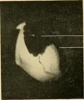 Picture 54 of 62 from The alimentary tract : a radiographic study (1915), leaf 192