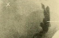 An illustration from The alimentary tract : a radiographic study (1915)