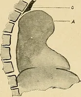 An illustration from The alimentary tract : a radiographic study (1915)