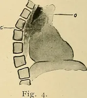An illustration from The alimentary tract : a radiographic study (1915)