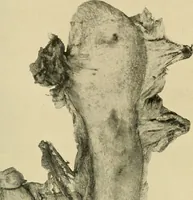 Picture 13 of 62 from The alimentary tract : a radiographic study (1915), leaf 66