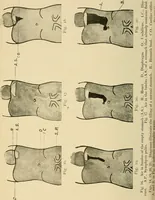 An illustration from The alimentary tract : a radiographic study (1915)