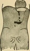 An illustration from The alimentary tract : a radiographic study (1915)