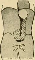 An illustration from The alimentary tract : a radiographic study (1915)