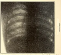 An illustration from The American journal of the medical sciences (1827)