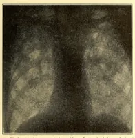 An illustration from The American journal of the medical sciences (1827)