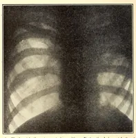 An illustration from The American journal of the medical sciences (1827)