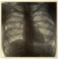 An illustration from The American journal of the medical sciences (1827)