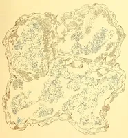 An illustration from The American journal of the medical sciences (1827)