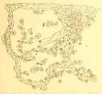An illustration from The American journal of the medical sciences (1827)