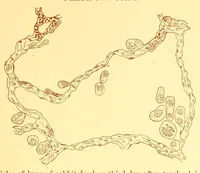 An illustration from The American journal of the medical sciences (1827)