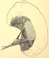 An illustration from The American journal of the medical sciences (1827)