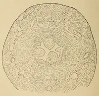 An illustration from The American journal of the medical sciences (1827)