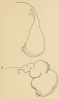 An illustration from The American journal of the medical sciences (1827)