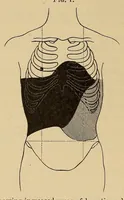 An illustration from The American journal of the medical sciences (1827)