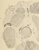 An illustration from The American journal of the medical sciences (1827)