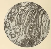 An illustration from The American journal of the medical sciences (1827)