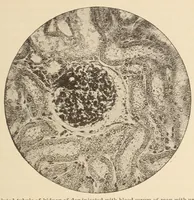 An illustration from The American journal of the medical sciences (1827)