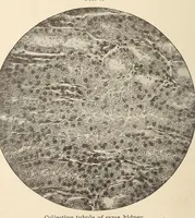 An illustration from The American journal of the medical sciences (1827)