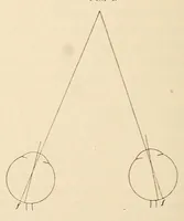 An illustration from The American journal of the medical sciences (1827)