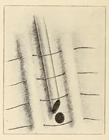 Picture 10 of 12 from The American journal of the medical sciences (1827), leaf 424
