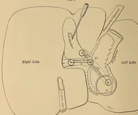 An illustration from The American journal of the medical sciences (1827)