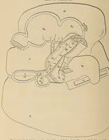 An illustration from The American journal of the medical sciences (1827)